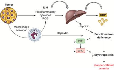 Pathogenesis and Treatment Options of Cancer Related Anemia: Perspective for a Targeted Mechanism-Based Approach